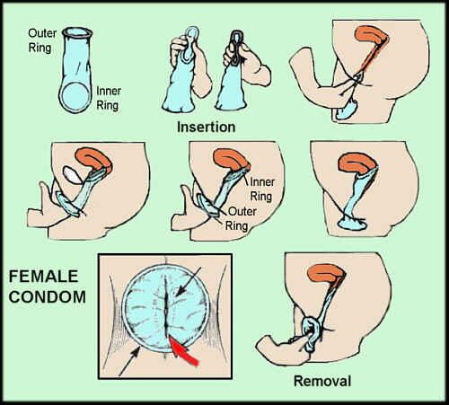 FC2 Female condom 1p
